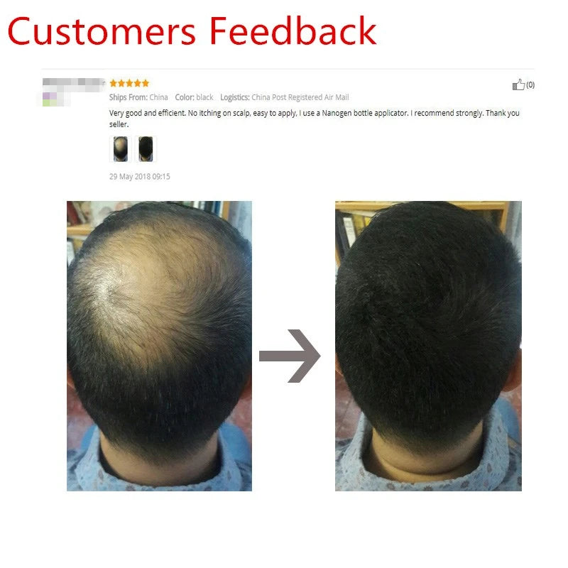 Sevich 25g Hair Fiber Instant Hair Growth Keratin Hair Building Fibers Powder Applicator Comb Extension Hair In Second 10 Color