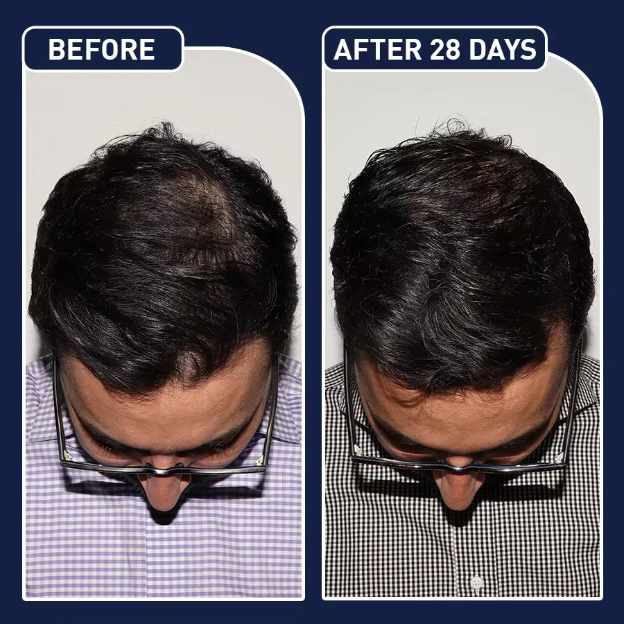 FEG Organic Anti Hair Loss Hair Growth Treatment Oil For Thicker Long Hair