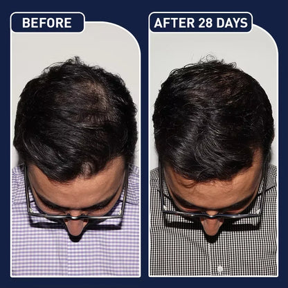 FEG Organic Anti Hair Loss Hair Growth Treatment Oil For Thicker Long Hair