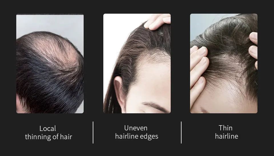 10 Colors Sevich Hair Fibers Keratin Fibers Applicator Hair Building Fibers Spray Hair Loss Instant Regrowth Thickening Powders