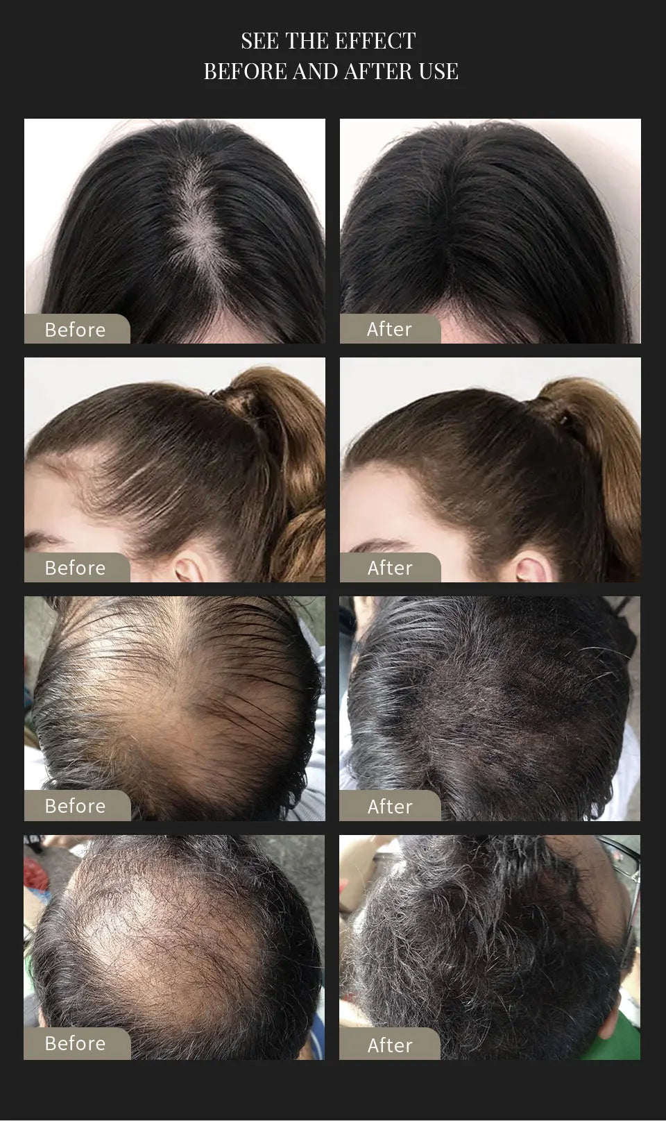 10 Colors Sevich Hair Fibers Keratin Fibers Applicator Hair Building Fibers Spray Hair Loss Instant Regrowth Thickening Powders