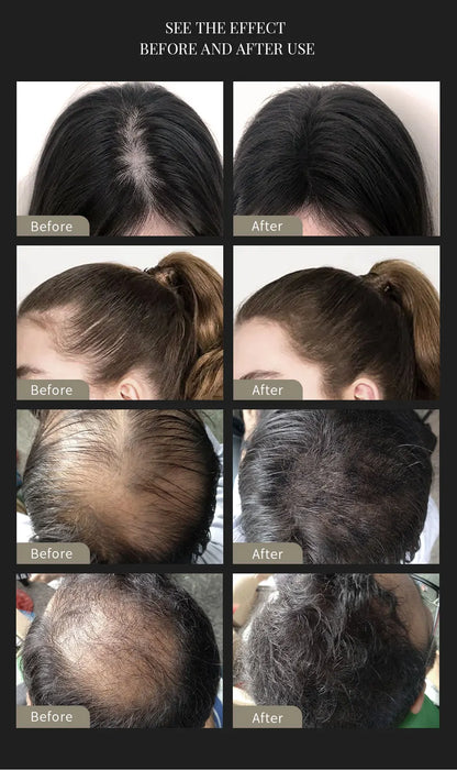 10 Colors Sevich Hair Fibers Keratin Fibers Applicator Hair Building Fibers Spray Hair Loss Instant Regrowth Thickening Powders