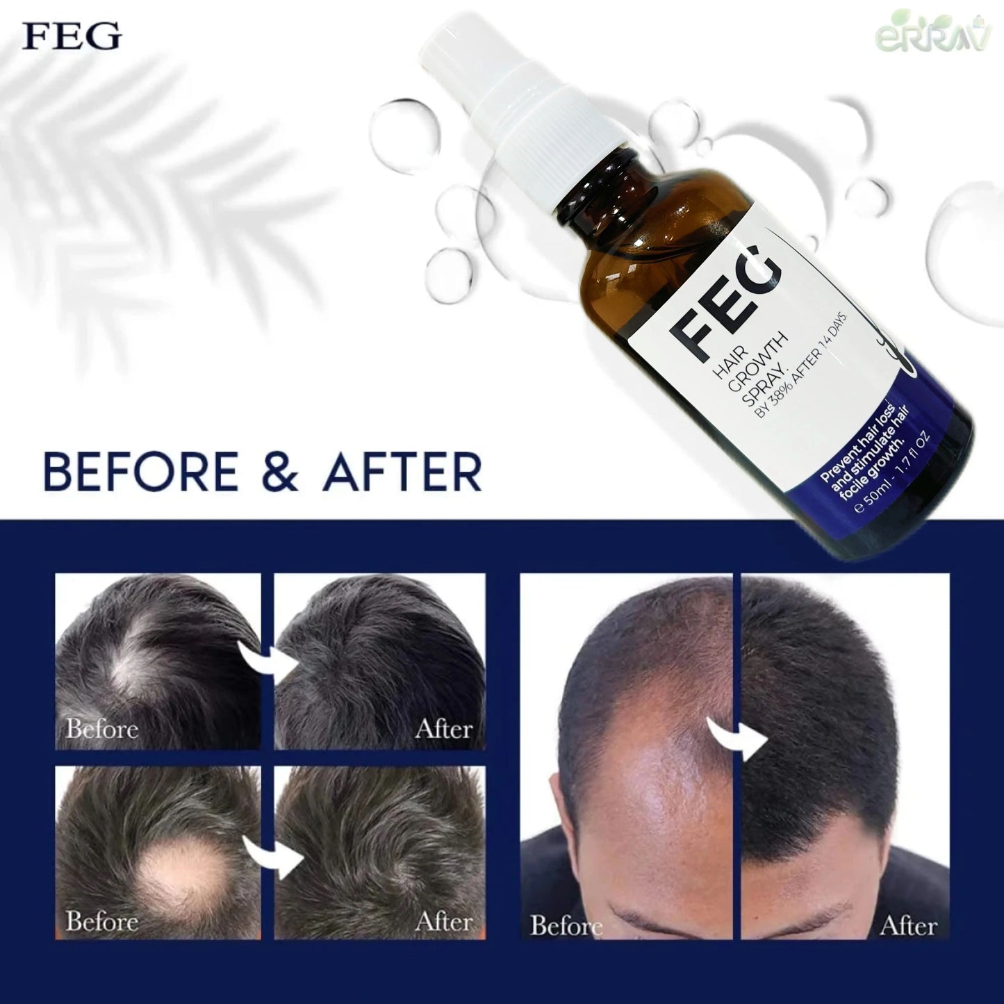 FEG Organic Anti Hair Loss Hair Growth Treatment Oil For Thicker Long Hair