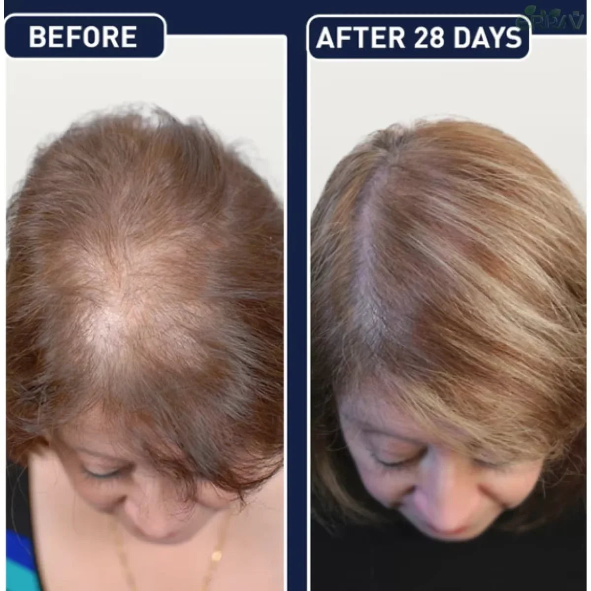 FEG Organic Anti Hair Loss Hair Growth Treatment Oil For Thicker Long Hair