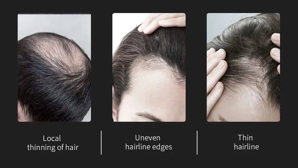 10 Colors Sevich Hair Fibers Keratin Fibers Applicator Hair Building Fibers Spray Hair Loss Instant Regrowth Thickening Powders